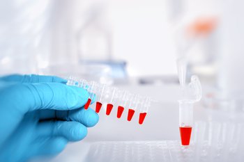 Rhythm’s lead biomarker successfully differentiates between cancer and healthy samples