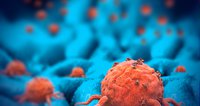 Imugene Meets All Endpoints in Phase 1b Gastric Cancer Immuno-oncology Trial