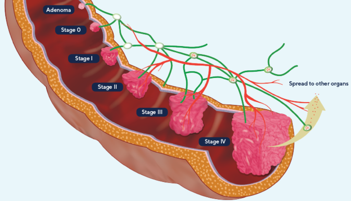 Rhythm Biosciences’ ColoSTAT recognised in global markets