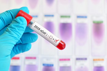 A listed Aussie company battling the Coronavirus